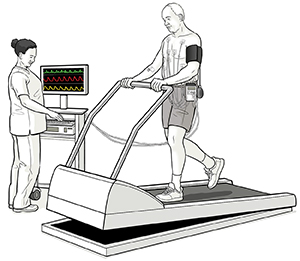 Man with electrodes on chest walking on treadmill for stress myocardial perfusion scan. Health care provider monitoring test.