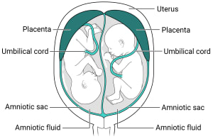 Within the uterus, there are two placentas with their own amniotic sac, amniotic fluid, and fetus inside.